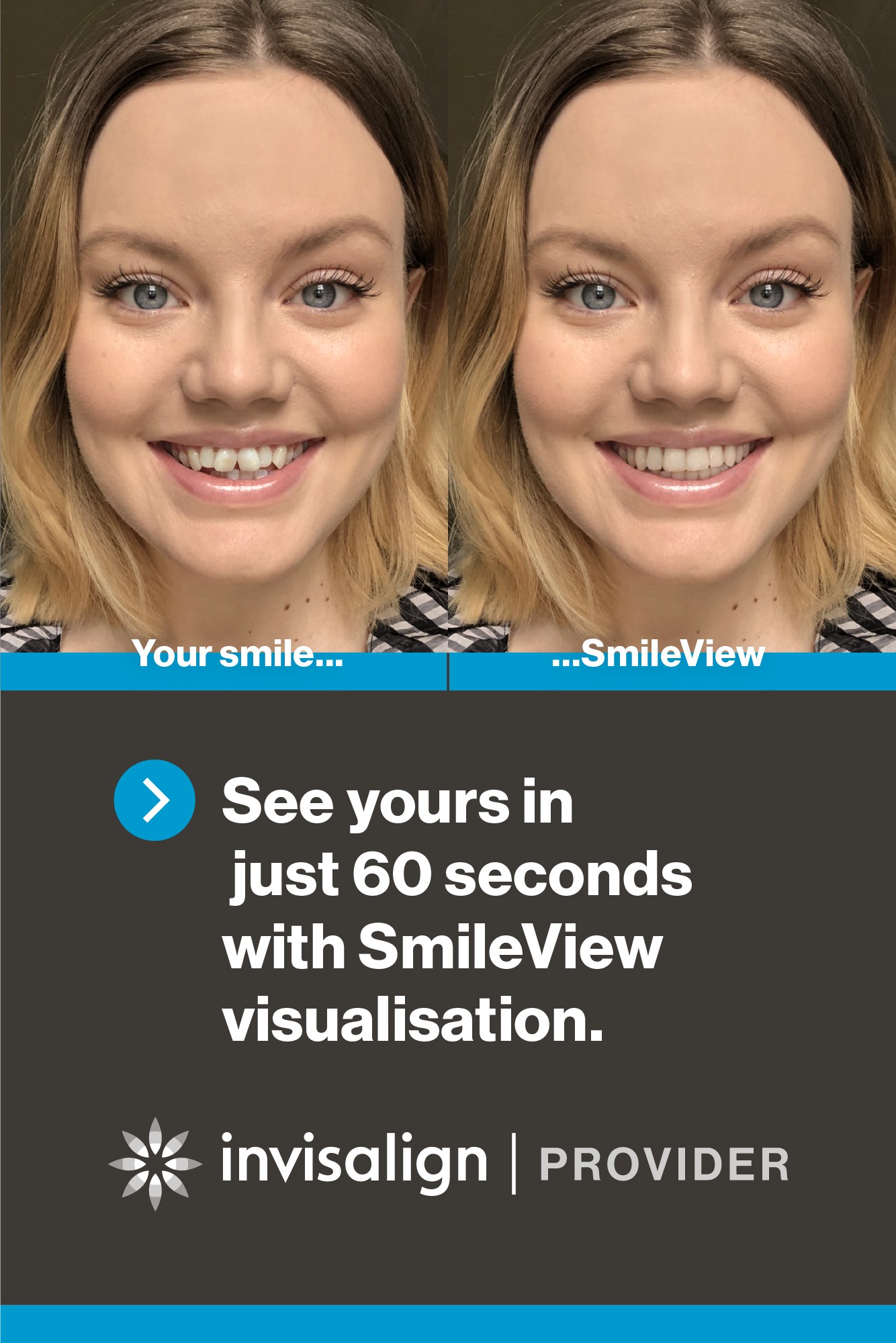 SmileView Invisalign 